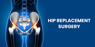 Hip Replacement Surgery in Sarangarh-Bilaigarh