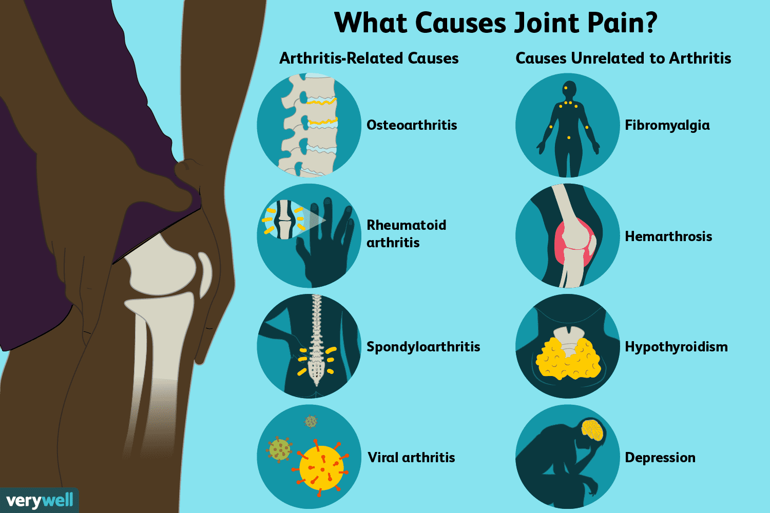Joint Pain Treatment in Raipur