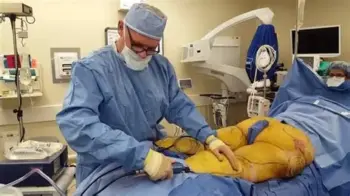 Liposuction in Gadchiroli