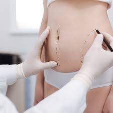 Liposuction in Sakti
