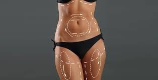 Liposuction in Umaria