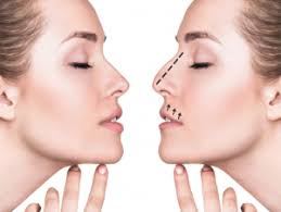 Rhinoplasty in Narayanpur