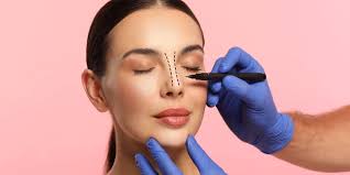 Rhinoplasty in Narmadapuram