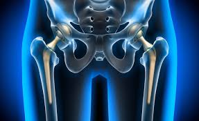 Robotic Hip Replacement In Betul