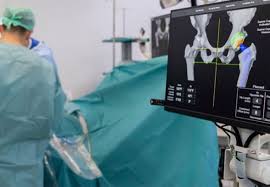 Robotic Hip Replacement In Neemach