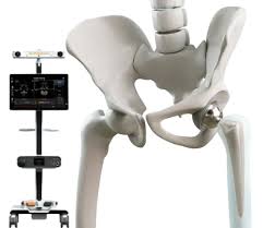 Robotic Hip Replacement in Rajnandgaon