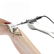 Robotic Joint Replacement in Narayanpur