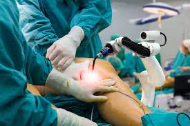 Robotic Knee Replacement In Umaria