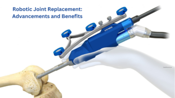 Robotic joint replacement in gadchiroli