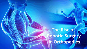 Robotic orthopedic surgery in Umaria