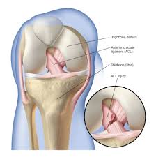 Sports Injury Treatment in Raipur | Dr. Siddharth Jain at AIAS