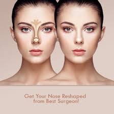 rhinoplasty-in-raigarh